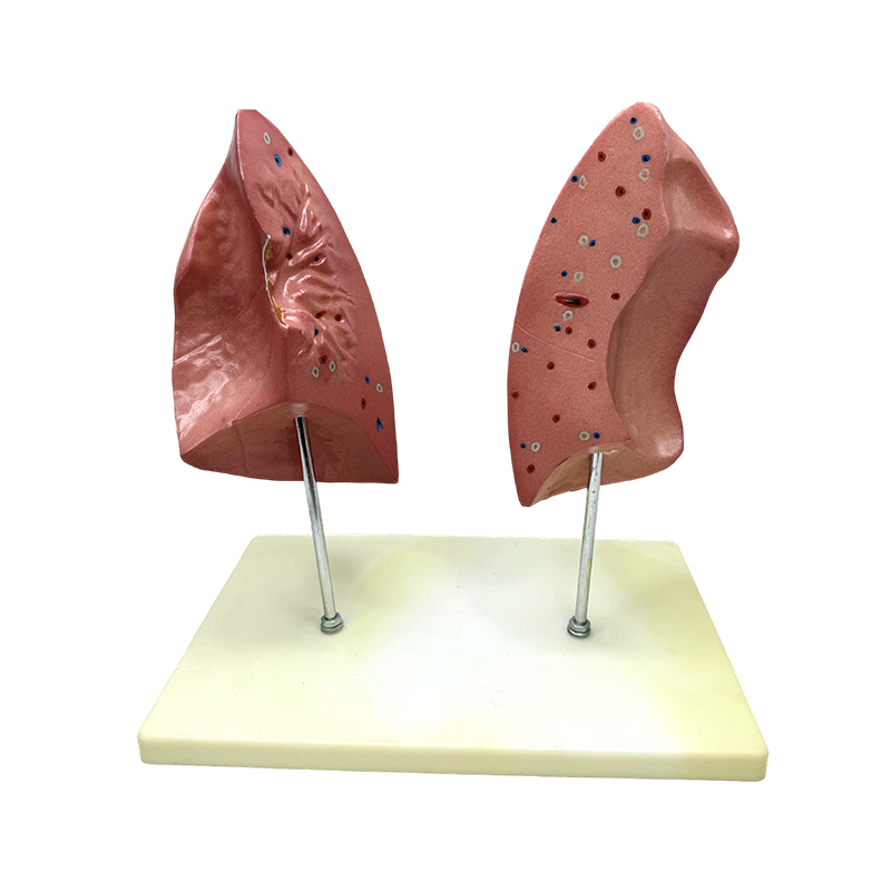 Exemplar biologicum docens pulmonem dextrum et sinistrum exemplar viscerum humanorum pulmonis anatomicum