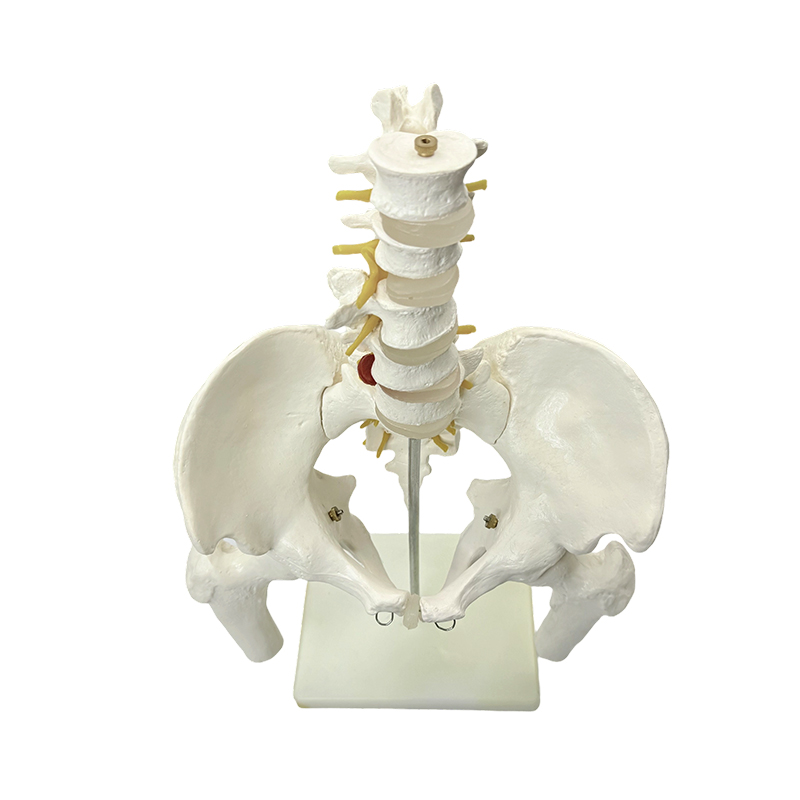 Medica institutio ossis pelvis humani exemplar anatomiae